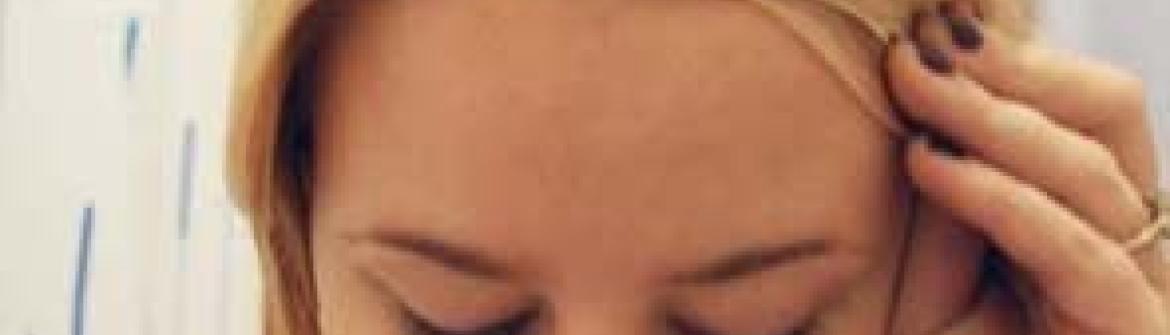 Alopecia Areata